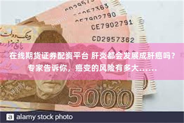 在线期货证券配资平台 肝炎都会发展成肝癌吗？专家告诉你，癌变的风险有多大……